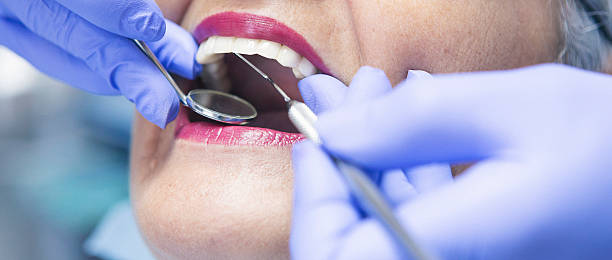Best Emergency Treatment for Oral Infections in Kirkland, WA